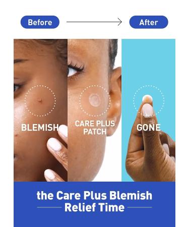 Olive Young Care Plus Spot Patch 1 Pack | Hydrocolloid Acne Pimple Patch for Troubled Skin | 102 Count - 10mm*72ea + 12mm*30ea - Buy Online on GoSupps.com