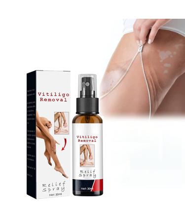 Vitiligoremoval Relief Spray Vitiligo removal Relief Spray Vitiligo Skin Repair Spray Vitiligo Treatment Spray White Spot Spray Vitiligo Care Spray for Skin Care Reduces White Spots on Skin (1Pcs)