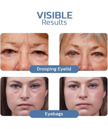 flysmus openeyes awaken peptide lifting eye gel 2023 for women open eyes awaken peptide lifting eye gel for women derma plus firm peptide firming eye gel (2PCS) - Buy Online on GoSupps.com