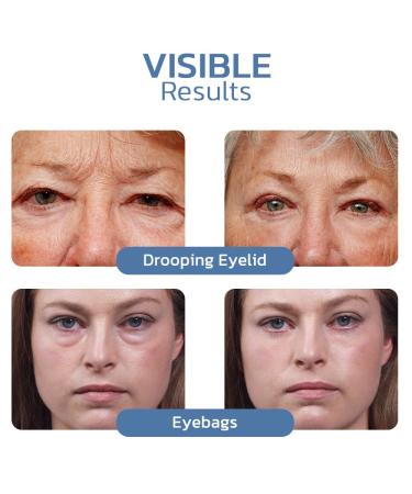 Lovilds & Openeyes Peptide Tight Eye Gel Rejuvenating Eye Lifting Gel for Men & Women (2PCs) Best International Shipping - Buy Online on GoSupps.com