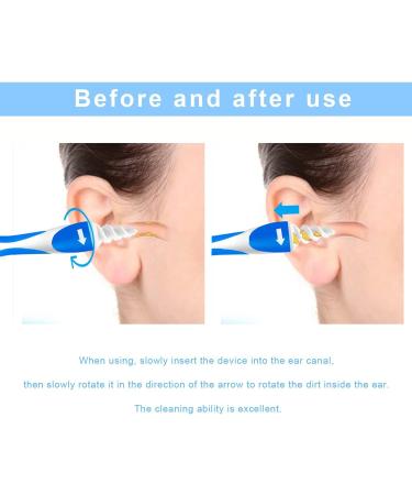 Q Grips Ear Wax Remover Kit - Soft Spiral Design with 16 Replacement Heads & 4 Dual-Head Ear Pickers - Gentle Ear Cleaning Tool for Adults and Kids - Buy Online on GoSupps.com