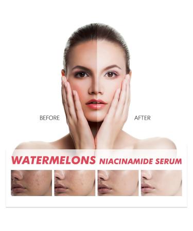 Watermelon Moisturizer Facial Serum - Hydrating Glow Priming Liquid Highlighter | International Shipping - Buy Online on GoSupps.com