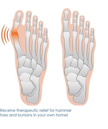 Toe Resistance Bands for Bunion Relief - Gel Corrector & Big Toe Stretcher - Tension Exercise Straps for Hammer & Overlapping Toe Alignment (2 Pcs - Buy Online on GoSupps.com