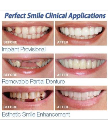 Temporary Fake Dentures Teeth for Broken, Gap & Missing Teeth - Improve Smile - Buy Online on GoSupps.com