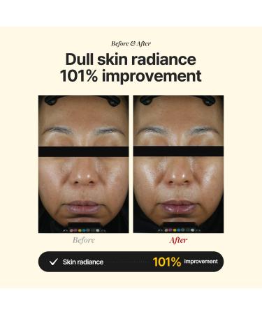 Buy MEDITHERAPY VITA REAL Shot Toning Ampoule | Pure Vitamin C Serum for Blemish Care & Radiance | Korean Skincare - 0.5 fl. oz - Buy Online on GoSupps.com