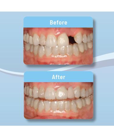 OrVance Retainer Cleaner Tablets (28 Count) & OrVance Pontics (16 Count) - Buy Online on GoSupps.com