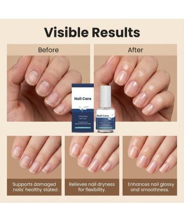 Soin fortifiant pour ongles brillants et intensifs fortifiant pour ongles fragiles et ab m s soin r parateur pour ongles de pieds cassants et d doubl s huile nourrissante pour cuticules (2PCS) - Buy Online on GoSupps.com