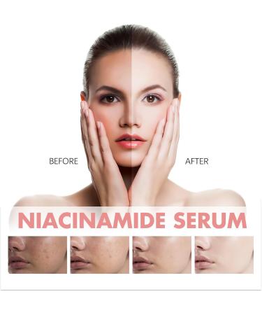 KOAHDE 70% Niacinamide Serum Anti-Aging Face Serum with Peach Extract Brightening Hydrating Face Glow Serum Face Moisturiser Anti-Aging Face Serum Peach Essence 70% Niacinamide Serum 30ML - Buy Online on GoSupps.com