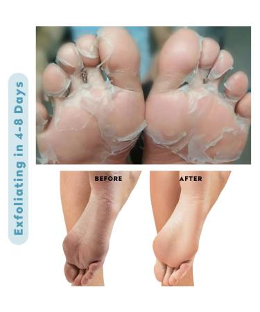 Foot Peel Mask for Smooth Feet - Exfoliating Treatment for Cracked Heels and Calluses - 2 Pack - Buy Online on GoSupps.com