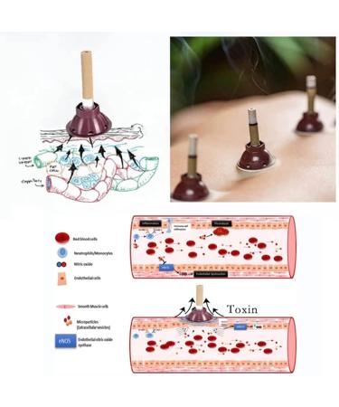 60-Piece Moxibustion Sets for Energy Gathering & Detoxification | SLI_Mming Moxa Sticks - International Shipping Available - Buy Online on GoSupps.com