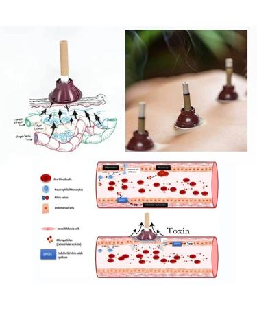 Buy Moxibustion Sticks - 20/40/60 Sets for Energy & Detoxification | International Shipping Available - Buy Online on GoSupps.com