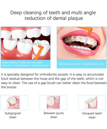 60 Interdental Brushes for Adults | Slim Braces Cleaner & Orthodontic Care | Orange & Blue Tension Brushes - Fast International Shipping - Buy Online on GoSupps.com