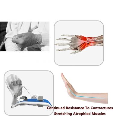 Wrist Orthotics Finger Strengthener Exerciser with Adjustable Knob and +90 /-90 Angle Line-of-Force-Guided Design Fingers Stretch Naturally for Sequelae of Cerebral Hemorrhage right - Buy Online on GoSupps.com
