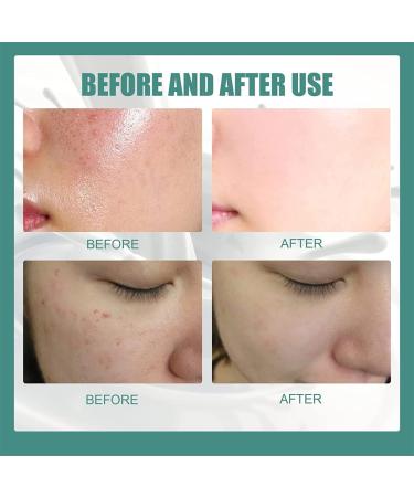  Chagoo Flysmus Silk Protein Melanin Fading Soap 60g Collagen Milk Whitening Soap Natural Skin Repair Facial and Body Soap (3pcs) - Buy Online on GoSupps.com