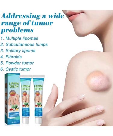 Buy FENGYANG 2PCS Lipoma Removal Cream - Herbal Solution for Lipom Lumps & Lymphatic Detox - Buy Online on GoSupps.com