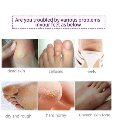 Lavender Foot Peel Mask 5 Pack - Natural Exfoliating Treatment for Dry Skin, Callus, and Rough Heels - Softens and Smooths Feet - Ideal Gift for Women, Mom, and Men - Buy Online on GoSupps.com