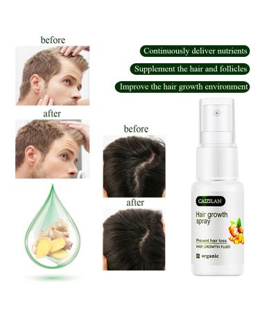 Serum Hair Growth - Accelerate Ginger Growth | Anti-Hair Failure | Strengthens Roots | 20ml for Men & Women - Buy Online on GoSupps.com