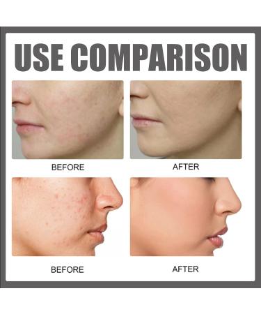 (2PCS)10% Niacinamide + 1% Zinc Serum For Face Moisturiser Minimise Pores Anti Aging & Wrinkle Face Serum Brightening & Glow Skin Dark Spot Remove & Even Skin Tone For Women 30ML * 2 - Buy Online on GoSupps.com