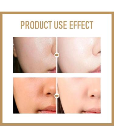 Rice Toner Rice Water Toner for Face Hydrating Rice Face Toner Hydrating Toner for Face Natural Moisturizer Glow Essence Smoothing Toner for Face Deep Hydrating Moisturizing Essence Toner 150 ml - Buy Online on GoSupps.com