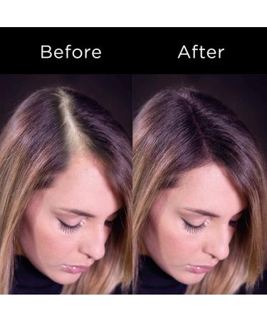 Buy R-Kerhair 100% Natural Keratin Thickening Fibers (Black) - Optional Applicator & Fixer - Fast International Shipping - Buy Online on GoSupps.com