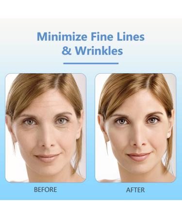 Botox Stock Solution & Anti Aging Serum (2Pcs) - Suitable For All Skin - Buy Online on GoSupps.com