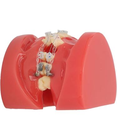Buy Ververt Touch Ceramic Dental Orthodontic Bracket Model - 24 Teeth Demo Model for Teacher Training | International Shipping Available - Buy Online on GoSupps.com