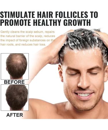 Root Activator Shampoo Hair Shampoo That Nourishes Your Scalp and Hair for Thinning Hair and Hair Loss. (2pcs) - Buy Online on GoSupps.com