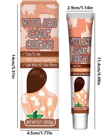  Generisch White Spot Cream - Vitiligo Relief Cream 20g against white spots on skin - Easy to use repigmenting and makeup remover cream - Improves skin pigmentation - Buy Online on GoSupps.com
