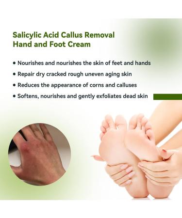 Maximum Strength 42% Urea Foot Cream Callus Remover for Dry, Hard Skin - Cracked Heel Repair 50g - Buy Online on GoSupps.com