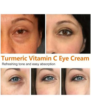 Lumistick For Eye Bags Lumibalm Eye Bags Turmeric Eye Cream Stick Turmeric Retinol Eye Cream Stick Eye Balm Stick Moisturizing For Bags And Reduces Puffiness Anti Aging Under Eye Cream - Buy Online on GoSupps.com