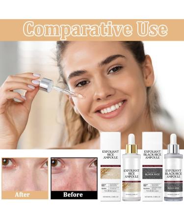 Peel Shot Glow Rice Ampoule Line Peel Shot Black Rice Ampoule White Rice Peeling S rum riz noir et blanc comme exfoliant pour le visage et le corps dissolvant de points noirs pour - Buy Online on GoSupps.com