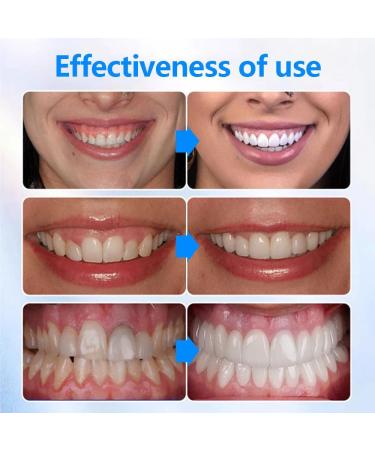 Remove Oral Gum Treatment Gel - Tooth Elevator Essence Pin & Protection - 3 PCs for Gum Residue Stains & Tartar Removal - Buy Online on GoSupps.com