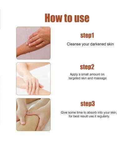 GHEART Acanthoclear Therapy Spray Acanthosis Nigricans Treatment Dark Knuckle Whitening Serum Dark Knuckle Whitening Serum Spray Dark Knees and Elbows Strong Whitening Essence Spray 30ml - Buy Online on GoSupps.com