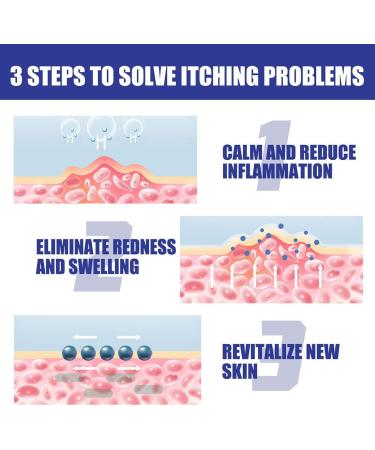 Psoriasis Repair Spray - Herbal Treatment for Plaque Psoriasis - Soothing Relief for Skin - 1pc - Buy Online on GoSupps.com