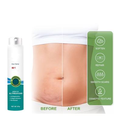 Heal Scar Care Spray | Advanced Formula for All Scar Types | 80g - Enhance Healing & Reduce Visibility - Buy Online on GoSupps.com
