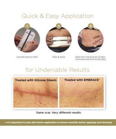 X-Large Silicone Scar Sheets - 6.3 Inch, FDA-Cleared, 30 Day Supply | Active Scar Defense for New Scars - Buy Online on GoSupps.com