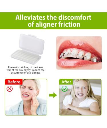 Orthodontic Wax for Braces - 10 Pieces & 50 Stripes | Relieve Irritation & Pain - White Dental Wax - Buy Online on GoSupps.com