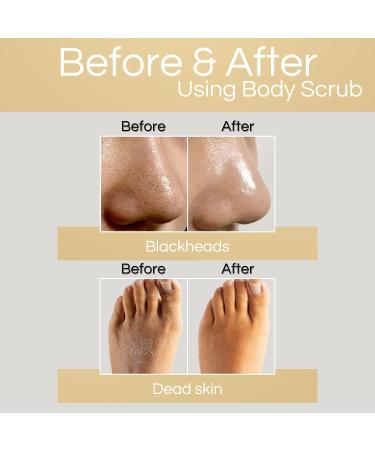 Coffee & Brown Sugar Body Scrub | Exfoliating Moisturizer with Vitamin E | Natural Skin Care for Stretch Marks Cellulite Dark Spots - 5 oz - Buy Online on GoSupps.com