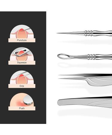 BEZOX Blackhead Tweezer and Acne Needle Set - Stainless Steel Comedone Extractor Kit - Buy Online on GoSupps.com