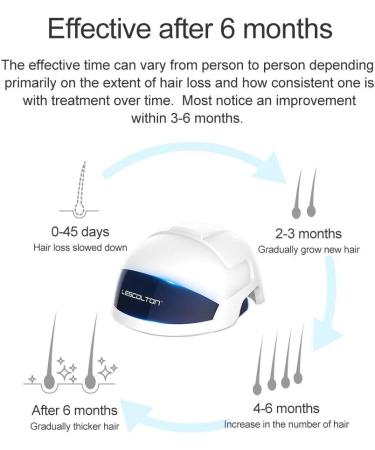 Hair Growth System for Men & Women - FDA-Cleared Hair Loss Treatment for Thinning Hair - Restore Thickness, Volume, and Density - Androgenetic Alopecia Solution - Buy Online on GoSupps.com