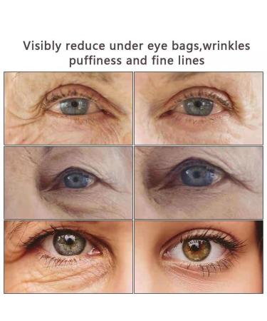 JTCAI Eye Cream 1oz - Anti Aging Treatment for Wrinkles, Puffiness, Dark Circles & Fine Lines - Under Eye Bags & Crow's Feet Reduction - 30ml - Buy Online on GoSupps.com