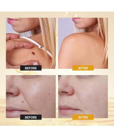 Bee Venom Skin Treatment Cream Anti-Aging Wrinkle Removal and Firming Face Skin Bee Venom Comprehensive Restoration Cream. (1 Pcs) - Buy Online on GoSupps.com