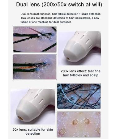 Hair Analyzer for Skin Diagnosis 10 Inch LCD Screen Digital Skin Detector Skin Analysis Machine Skin Pigment Tester for Skin Diagnosis and Treatment - Buy Online on GoSupps.com