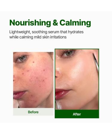 NACIFIC Cica PDRN Moisturize & Repair Duo - Calming Serum & Barrier Cream - Buy Online on GoSupps.com