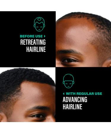 Unrefined Batana Oil for Hair Growth - Authentic Dr Sebi Batana Hair Mask - Organic Natural Hair Growth Oil - 4 oz from Honduras - Buy Online on GoSupps.com