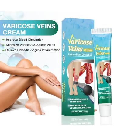Buy Lichengtai Varicose Veins Cream - 3PCs Spider Vein Treatment for Clearer Legs | Fast International Shipping - Buy Online on GoSupps.com