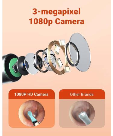BEBIRDPRO R3 PRO X3 Blue: Wi-Fi Ear Wax Remover with HD Camera, Intelligent Temperature Control, for Android and iOS - Buy Online on GoSupps.com