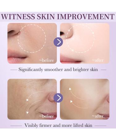 Retinol Serum for Face - Face Serum for Women - Anti-Aging & Anti-Wrinkle Serum - Hydrating Serum for Face - Serums Skincare - Moisturizing& Brightening - Buy Online on GoSupps.com