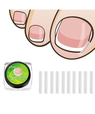 Jocaluyia Ingrown Toenail Corrector Strips 50Pcs Straightener Strip Curved Toenails Correction Patches Nail Support Spacer Tube Professional Pedicure Tools for Men Women Foot Care