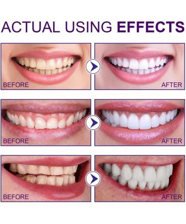 Deodorizing Teeth Whitening Powder Purple Toothpaste Powder Natural Teeth Whitening Toner Effectively Whitens Teeth and Removes Bad Breath (1PCS) - Buy Online on GoSupps.com